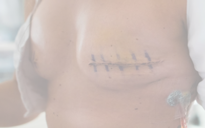 The Transformative Journey of Reconstructive Breast Surgery