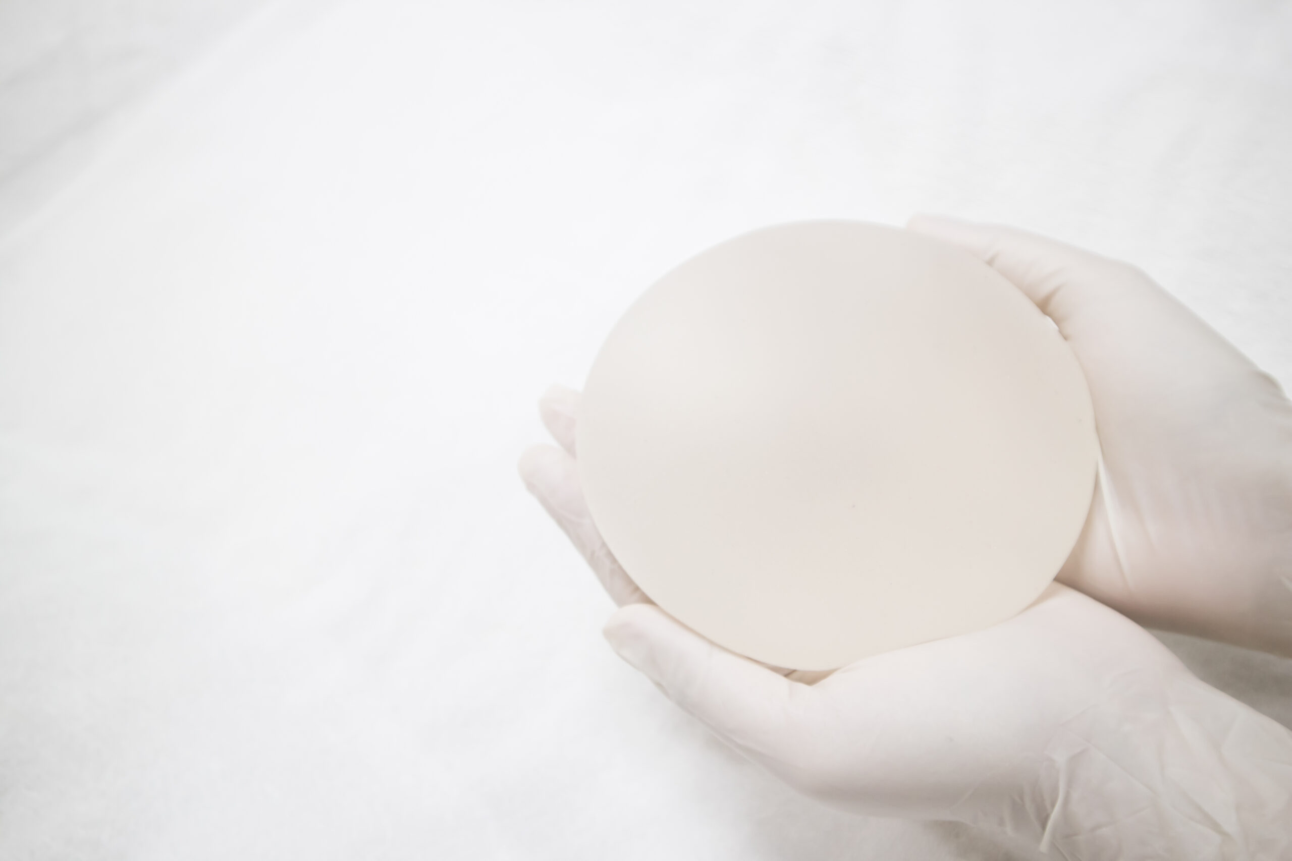 BREAST IMPLANT EXCHANGE implant removal breast augmentation BREAST IMPLANT EXCHANGE london clinic (+/- CAPSULECTOMY)