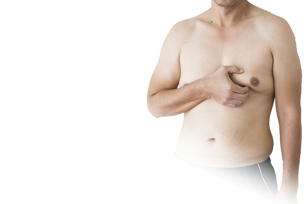 Gynecomastia london male breast removal london