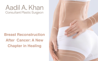 Breast Reconstruction After Cancer: A New Chapter in Healing