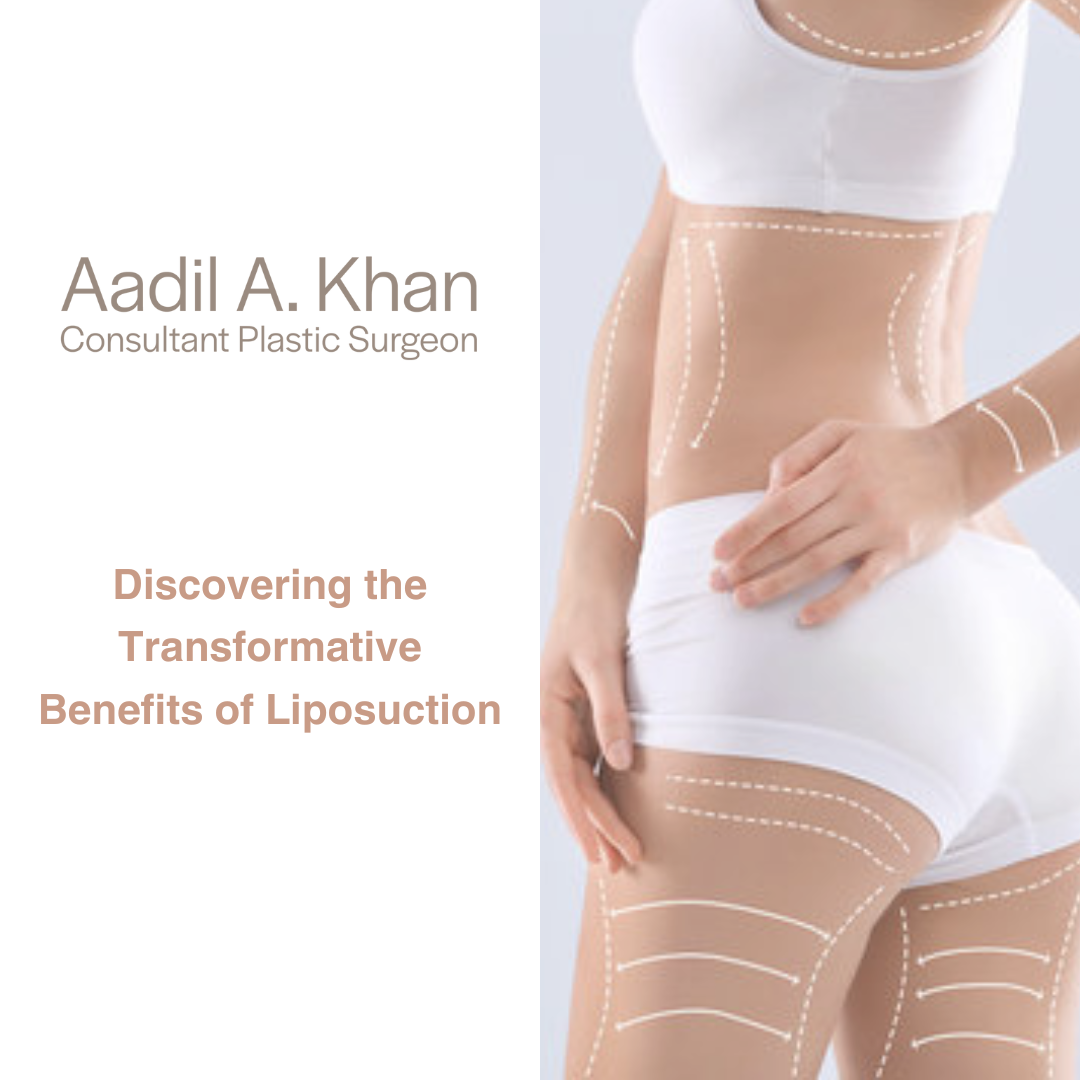 Discovering the Transformative Benefits of Liposuction