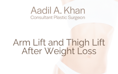 Arm Lift and Thigh Lift After Weight Loss
