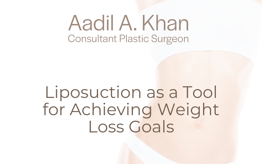 Liposuction as a Tool for Achieving Weight Loss Goals