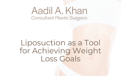 Liposuction as a Tool for Achieving Weight Loss Goals