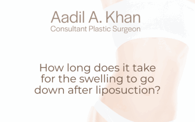 How long does it take for the swelling to go down after liposuction?