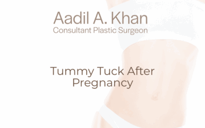 Tummy Tuck After Pregnancy