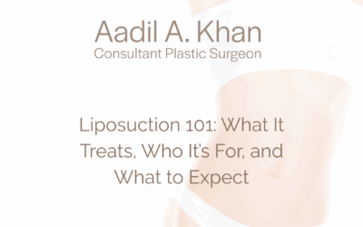 Liposuction 101: What It Treats, Who It’s For, and What to Expect