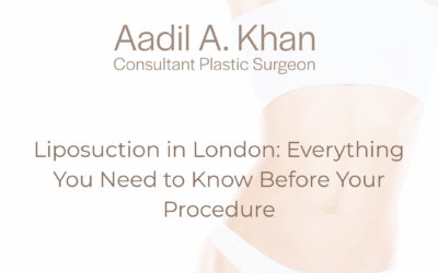 Liposuction in London: Everything You Need to Know Before Your Procedure