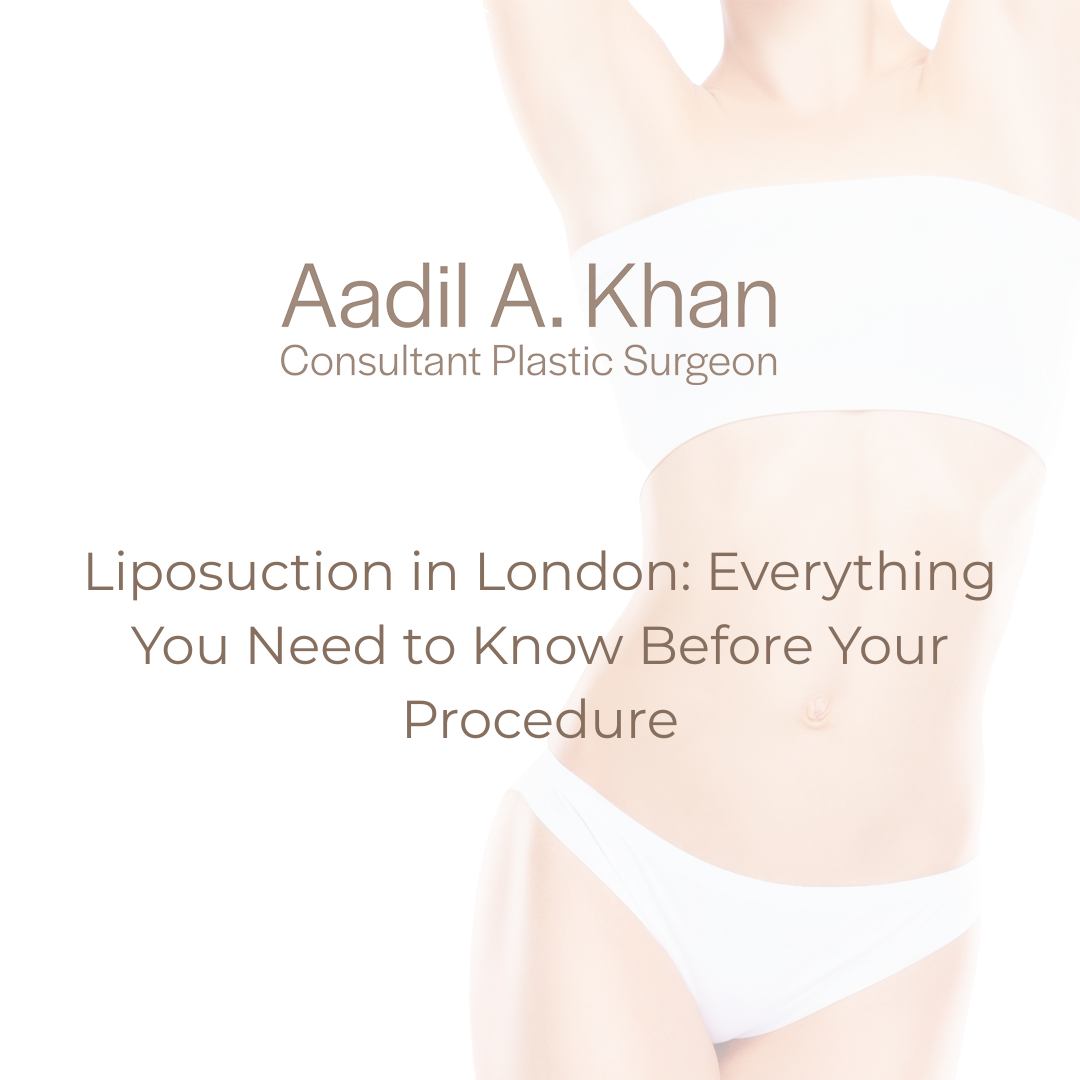 Liposuction in London: Everything You Need to Know Before Your Procedure
