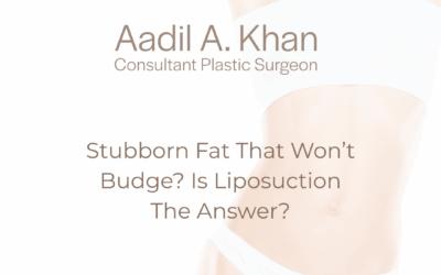 Stubborn Fat That Won’t Budge? Is Liposuction The Answer?